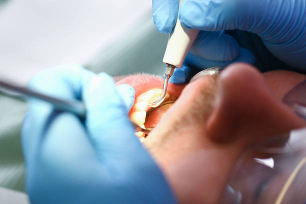 Best Urgent Care for Lost Fillings or Crowns in Bedford Heights, OH