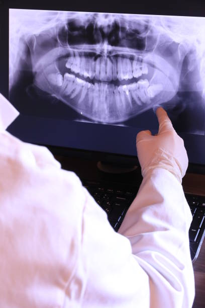 Best Emergency Tooth Extraction in Bedford Heights, OH